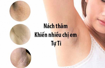 Những lưu ý cần biết khi triệt lông nách cần kiêng những gì ?