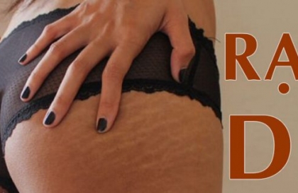 10+ Cách trị rạn da mông tuổi dậy thì tại nhà hiệu quả nhất dứt điểm tại nhà dễ thực hiện