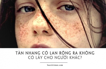  Giải đáp tàn nhang có bị lan ra không các vùng da khác có bị lây không ?