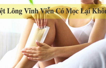 Triệt lông có mọc lại không? Các loại triệt lông công nghệ cao hiệu quả vĩnh viễn