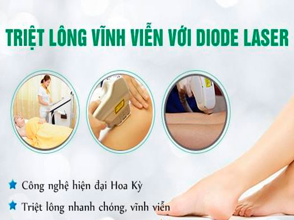 Công nghệ triệt lông Diode Laser công nghệ triệt lông hiêu quả cao an toàn