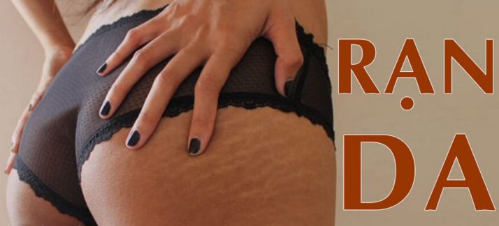 Cách trị rạn mông tại nhà hiệu quả nhất dứt điểm tại nhà dễ thực hiện