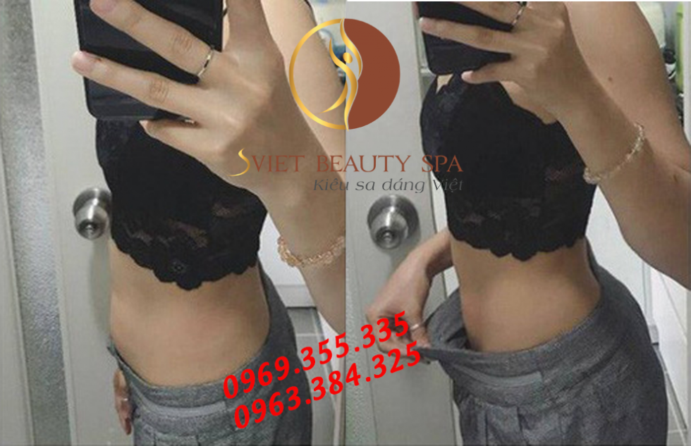 Tác dụng máy điêu khắc body tại Sviet Spa