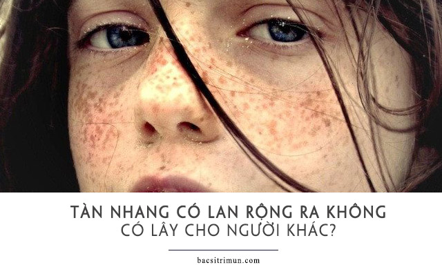 ​ Giải đáp tàn nhang có bị lan ra không các vùng da khác có bị lây không ?