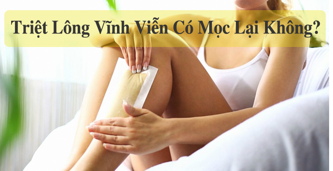 Triệt lông có mọc lại không? Các loại triệt lông công nghệ cao hiệu quả vĩnh viễn