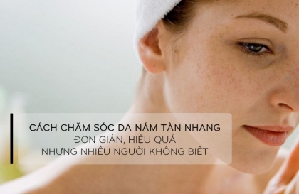 Thời điểm vàng giúp cải thiện nám da tàn nhanh