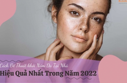 Giải đáp điều trị tàn nhang có hết không và cách điều trị tàn nhang hiệu quả
