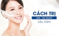 Phác đồ điều trị nám tàn nhang chuyên sâu chuẩn y khoa đúng cách