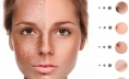 15+ Cách làm mờ tàn nhang chân sâu an toàn nhanh nhất tại nhà