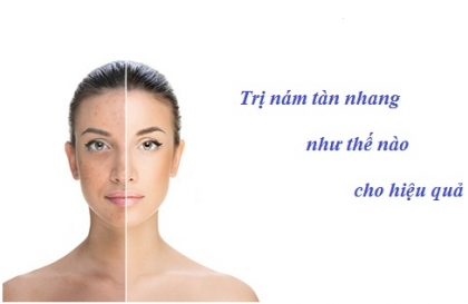 [Mách bạn] Top 3 Địa chỉ điều trị nám tàn nhang tại spa ở hà nội uy tín chất lượng giá rẻ