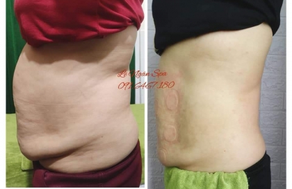 10 cách giảm béo bụng cho dân văn phòng giảm béo tại nhà