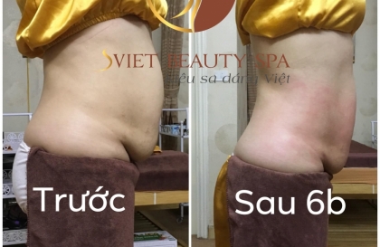 Tuyệt chiêu giảm béo bụng dưới hiệu quả cho chị em phụ nữ
