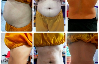 [Mách bạn] 5 Bài tập – cách giảm béo mỡ phần thân trên hiệu quả cho nam và nữ  