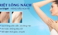Cảnh báo những trường hợp không nên triệt lông vĩnh viễn bằng công nghệ New E-Light