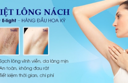 Cảnh báo những trường hợp không nên triệt lông vĩnh viễn bằng công nghệ New E-Light
