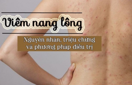 Triệt lông xong bị viêm nang lông nguyên nhân là vì sao ?  