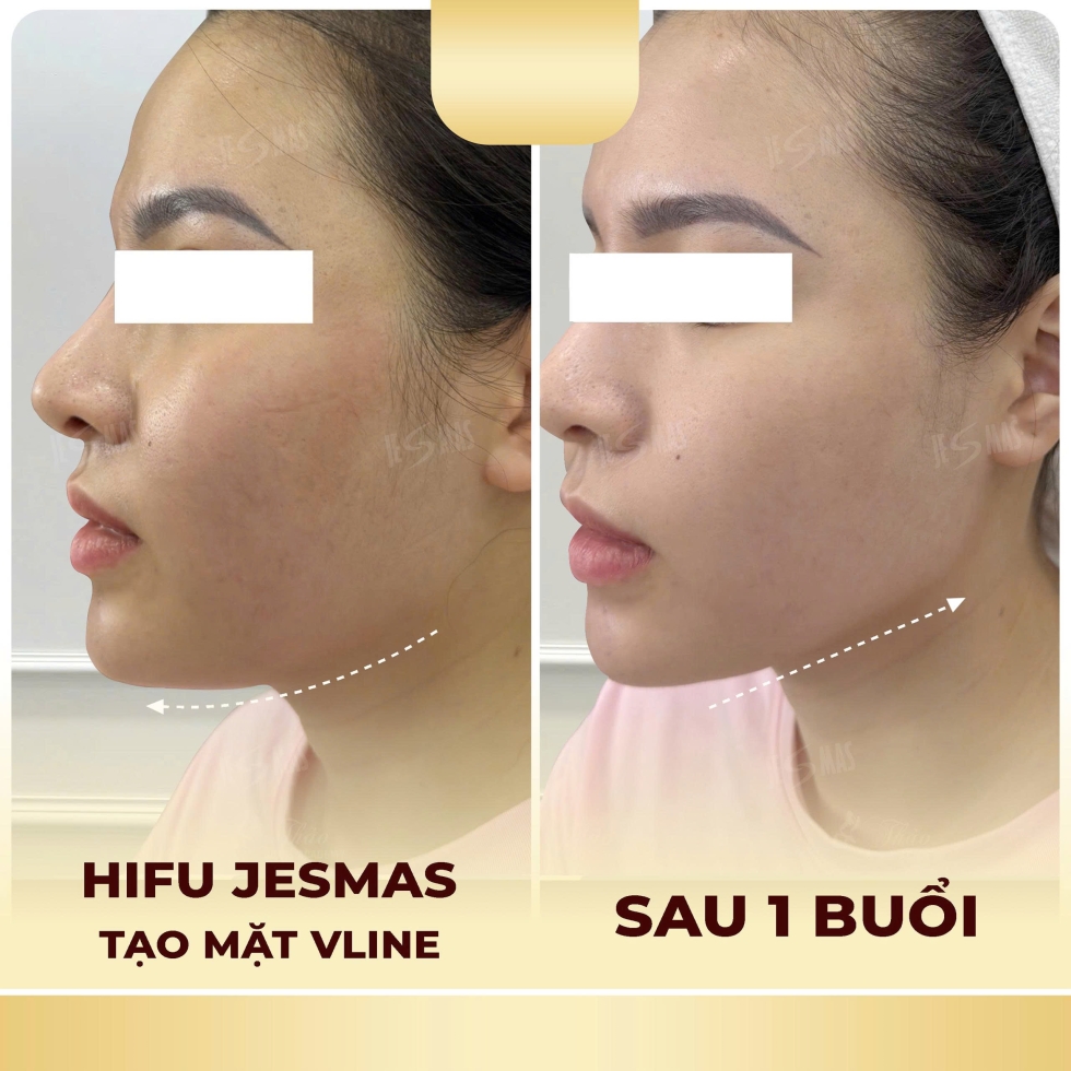 hifitaomatvlinevang