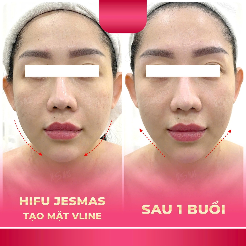 hifujesmastaomatvlinehong