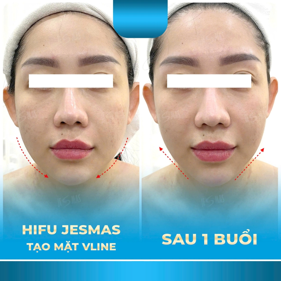 hifujesmastaomatvlinexanhnhat