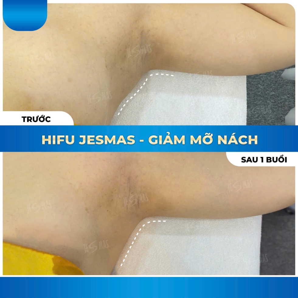 hifugiammanachxanhdam