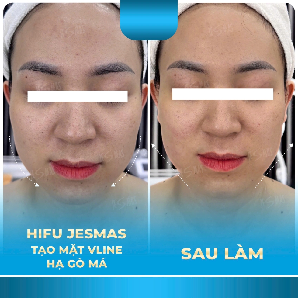 hifutaohinhvlinehagomaxanhnhat