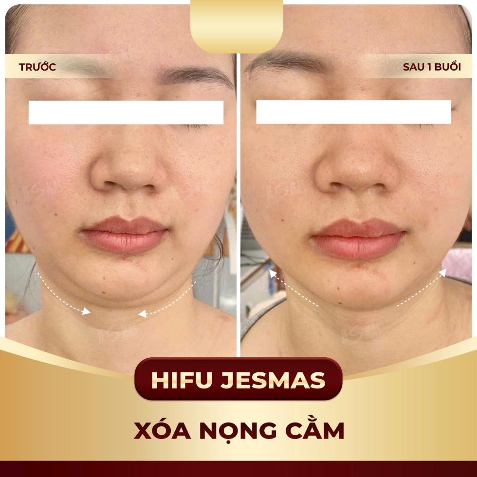 hifujesmasxoanongcamvang
