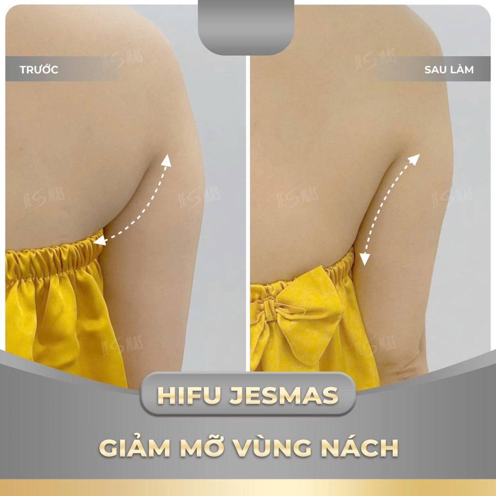 hifunachxam