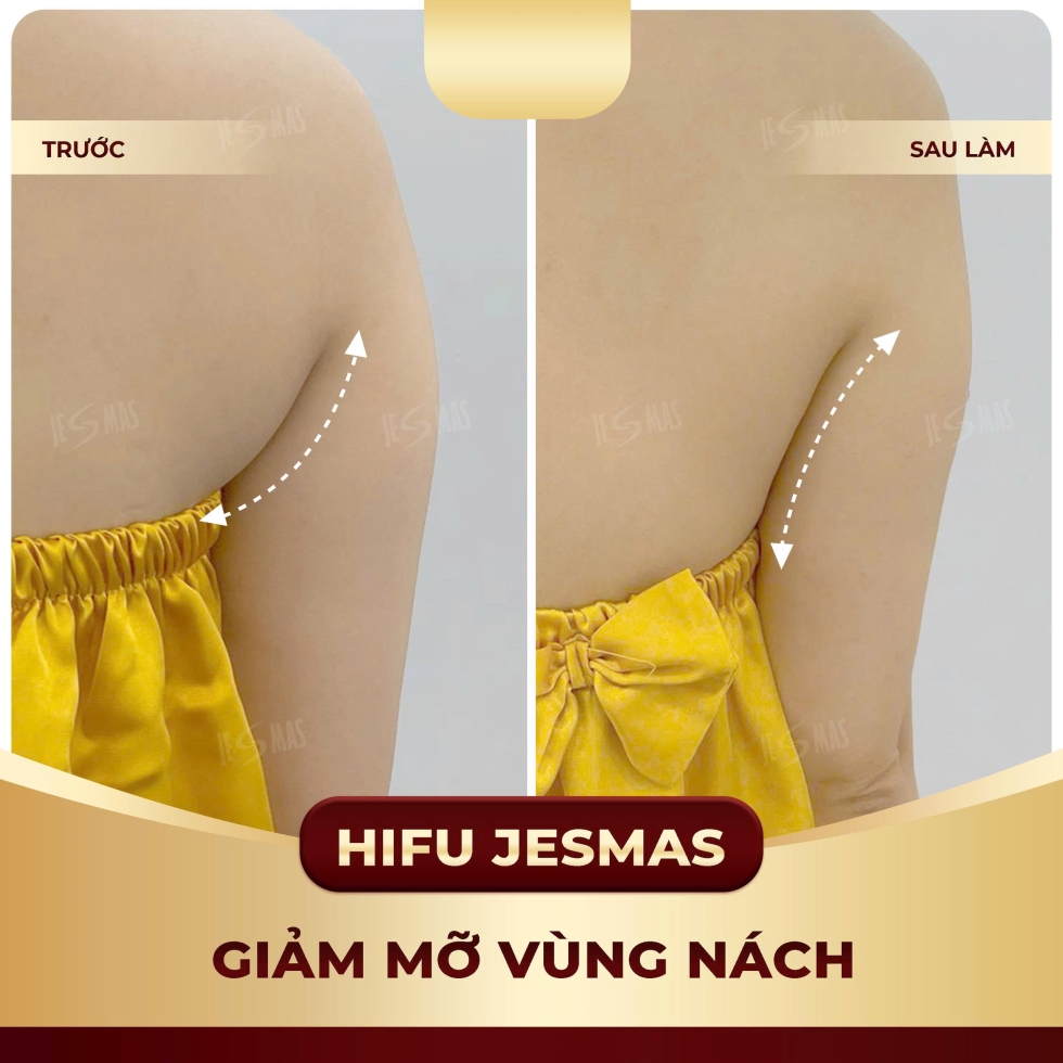 hifunachvang