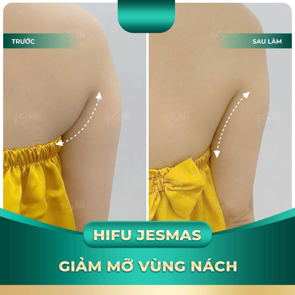 hifunachxanhnhat2
