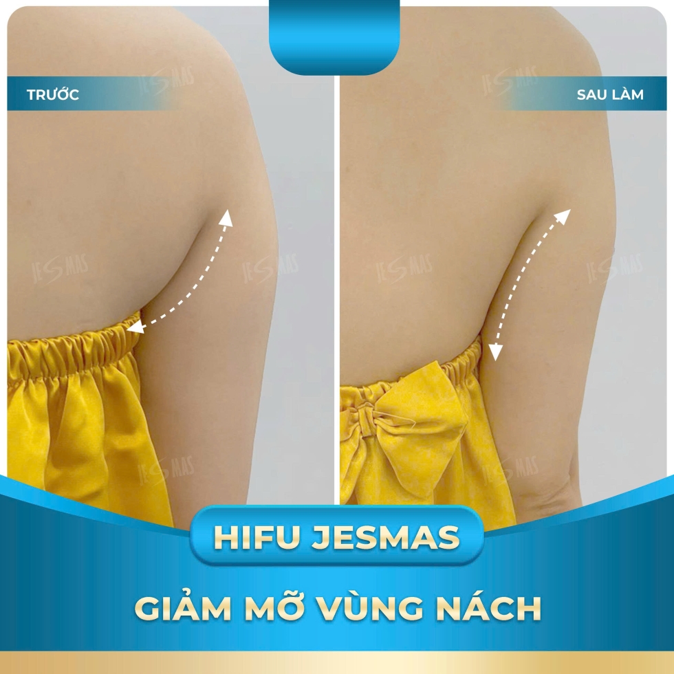 hifunachxanhnhat