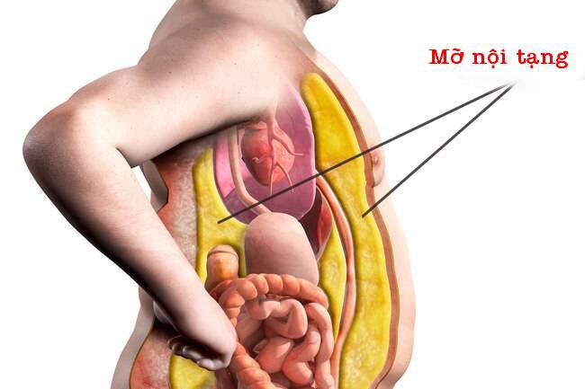 Giải pháp giảm béo hiệu quả cho từng dạng mỡ trong cơ thể