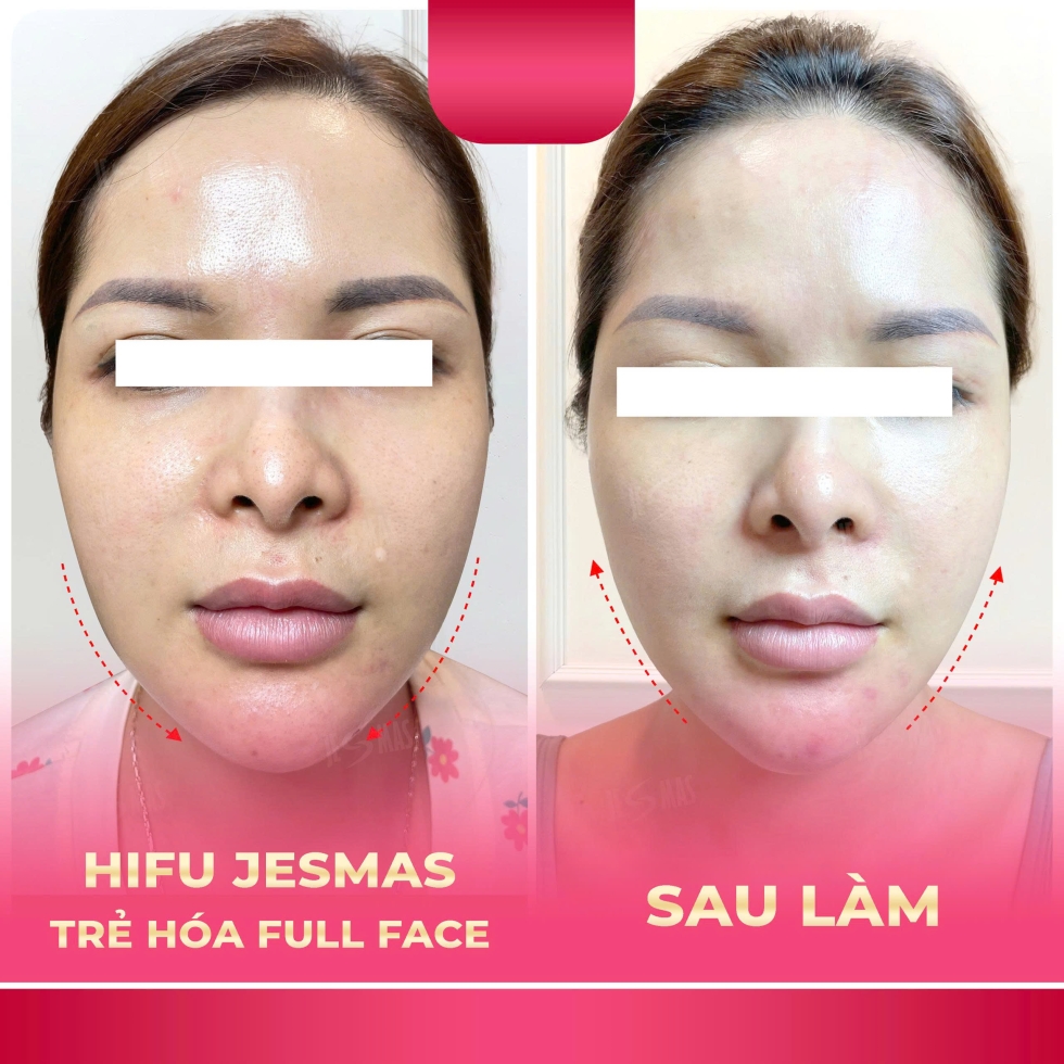 hifujesmastrehoafullfacehong