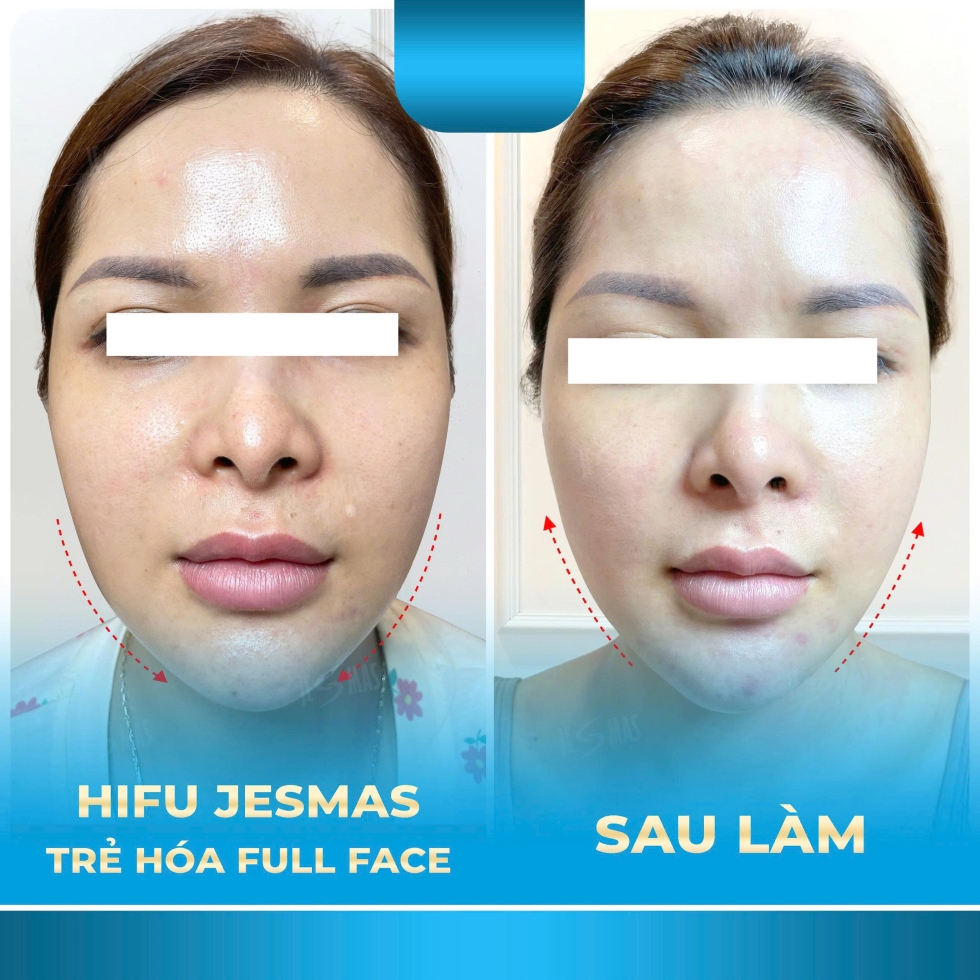 hifujesmastrehoafullfacexanhnhat