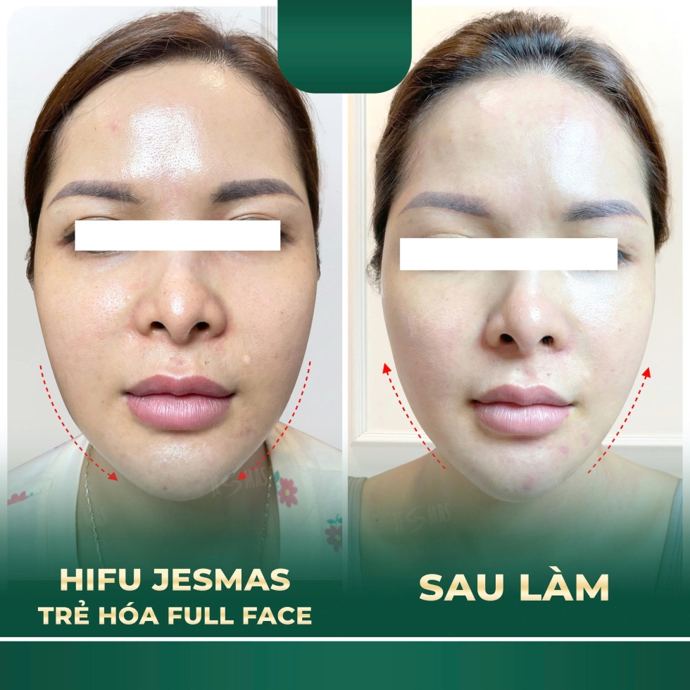 hifujesmastrehoafullfacexanhdam2