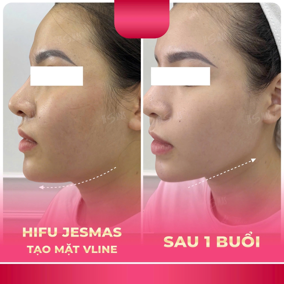 hifitaomatvlinehong