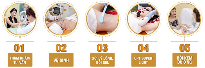 Quy trình triệt lông vĩnh viễn tại Sviet Beauty Spa