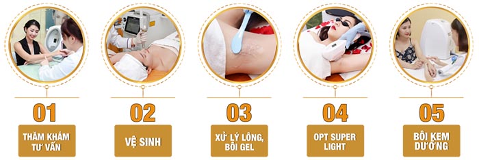 Công nghệ triệt lông OPT công nghệ cao giúp điều trị triệt lông an toàn