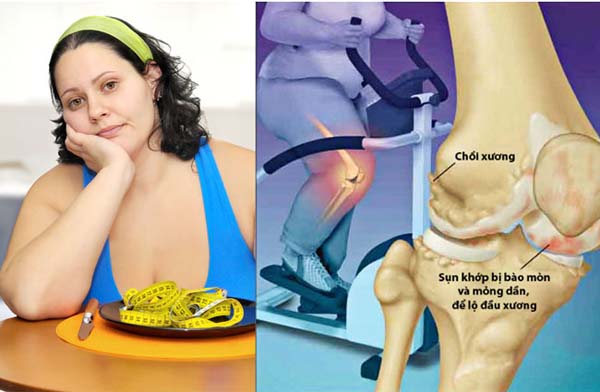 Tác hại của béo phì đối với sức khoẻ cơ thể