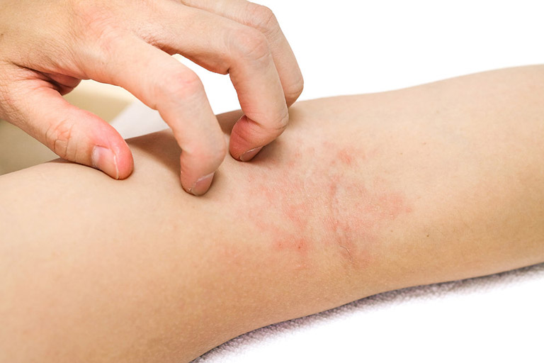 Triệt lông xong bị ngứa nguyên nhân – cách khắc phục hiệu quả tại spa
