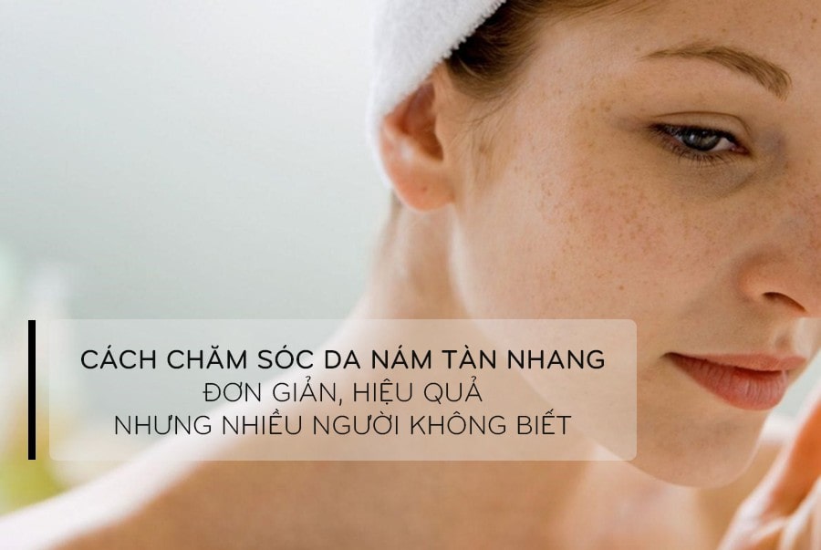 4 + Cách chăm sóc da mặt trị nám tàn nhang đơn giản hiệu quả từ thiên nhiên
