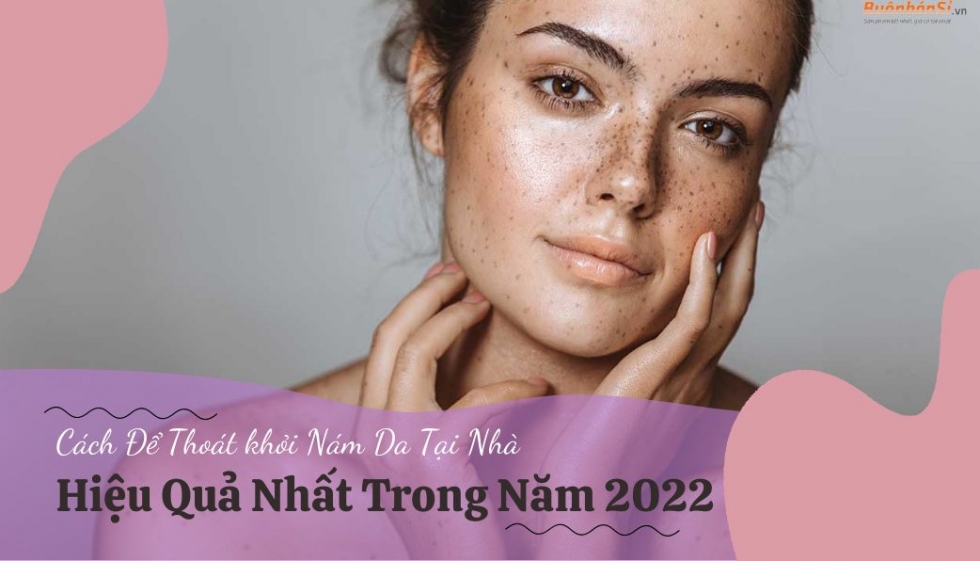 Cách điều trị tàn nhang hiệu quả tại nhà chuẩn y khoa