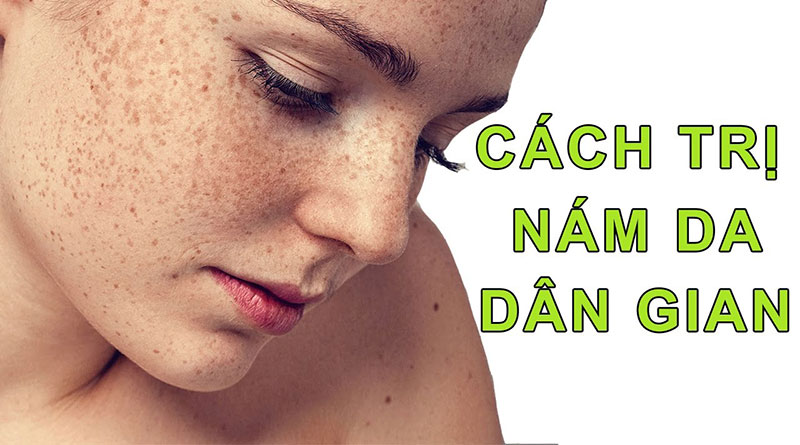 Cách trị nám tàn nhang dân gian