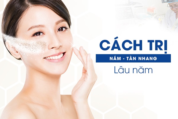 Điều trị nám tàn nhang chuyên sâu chuẩn y khoa đúng cách