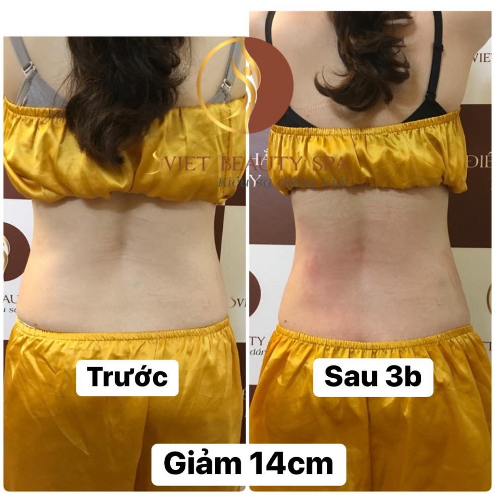 giảm béo tại sviet