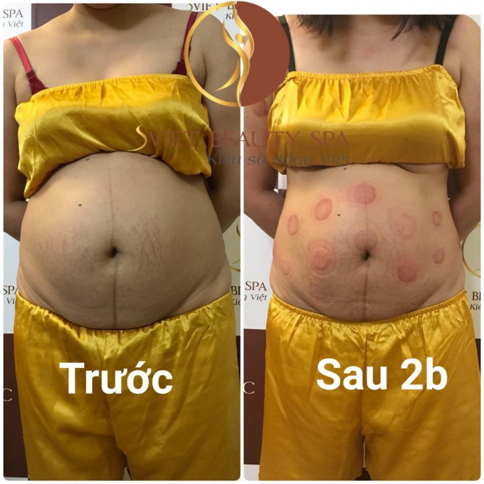 Chụp ảnh khách hàng đến sử dụng dịch vụ tại Spa