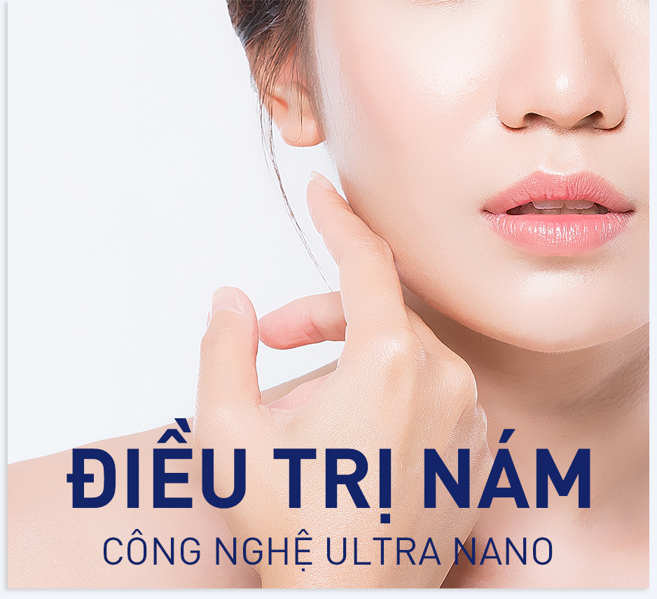 Công nghệ trị tàn nhang Ultra Nano tốt nhất