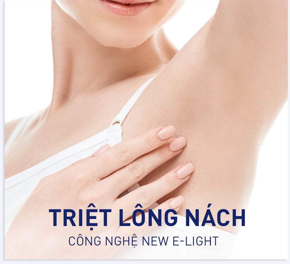 Triệt lông công nghệ an toàn hiệu quả tại Svietspa