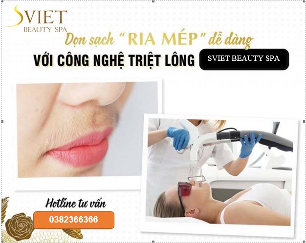 Công nghệ triệt lông ria mép cùng Sviet Spa