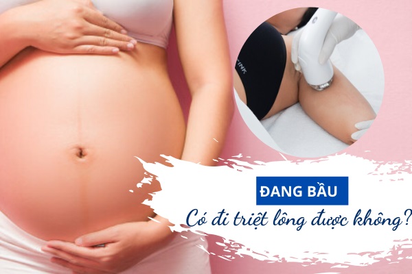Mẹ bầu có nên triệt lông vĩnh viễn không ?