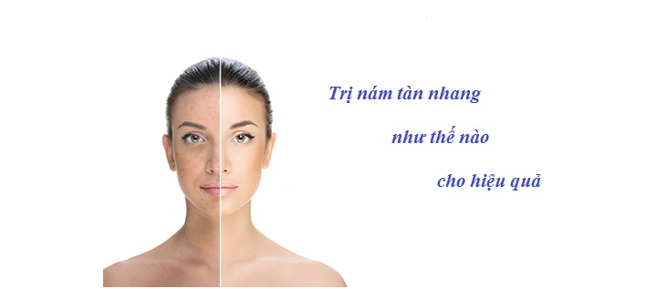 Một số biện pháp chữa nám tàn nhang hiệu quả